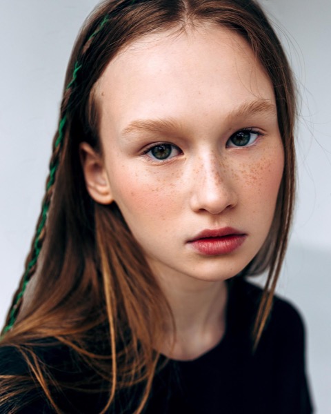 Young model with freckles and green hair streaks